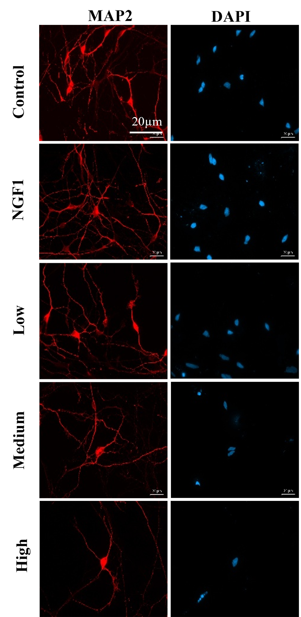 a series of images showing how rat neurons responded to various levels of caffeine exposure